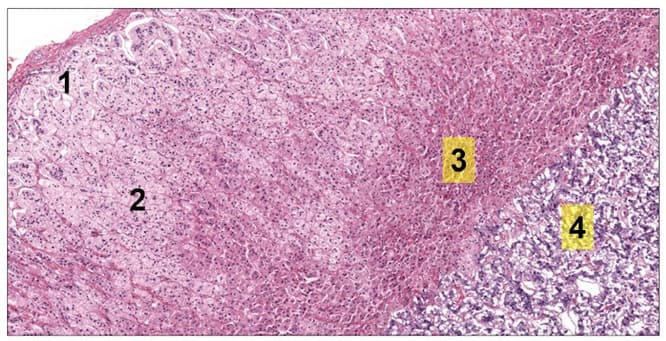 Histologia da suprarrenal