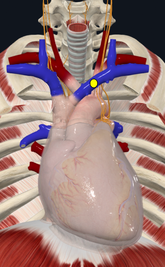 Modelo cervicotorácico anterior, com círculo amarelo sobre um vaso venoso transversal.