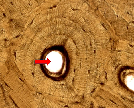 Micrografia de osso compacto com ósteons; seta no lúmen central de uma unidade concêntrica.