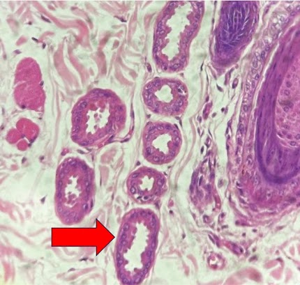 Micrografia da pele profunda com perfis tubulares enovelados; seta em um anexo cutâneo.