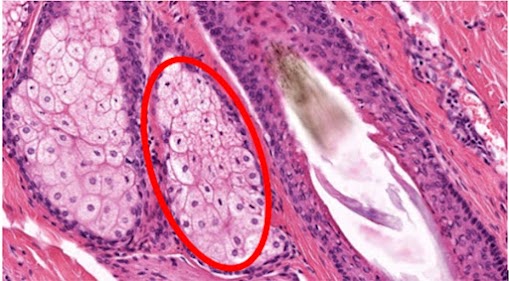 Micrografia de folículo piloso com lóbulos celulares adjacentes circundados.