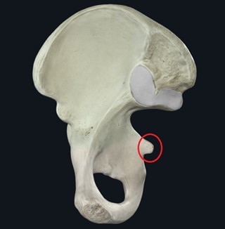 Modelo ou peça anatômica do material original com estrutura marcada para identificação.