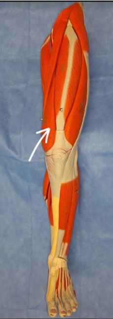 Modelo ou peça anatômica do material original com estrutura marcada para identificação.